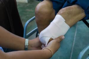 Amputazione del piede in un paziente diabetico