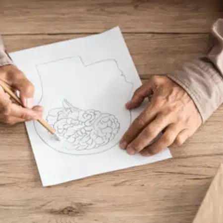 Alzheimer